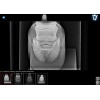 roentgen_app_2