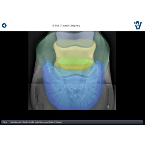 roentgen_app_3