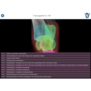 roentgen_app_4